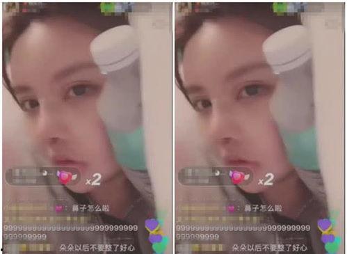 整容直播视频,美丽背后的真相与争议