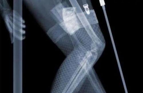 x光透视频,揭秘人体与物质的微观世界